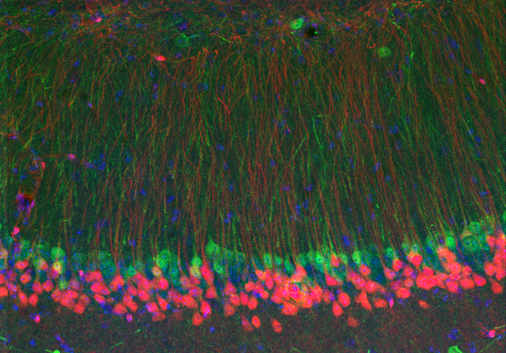 Different subytpes of pyramidal cells in hippocampal region CA1