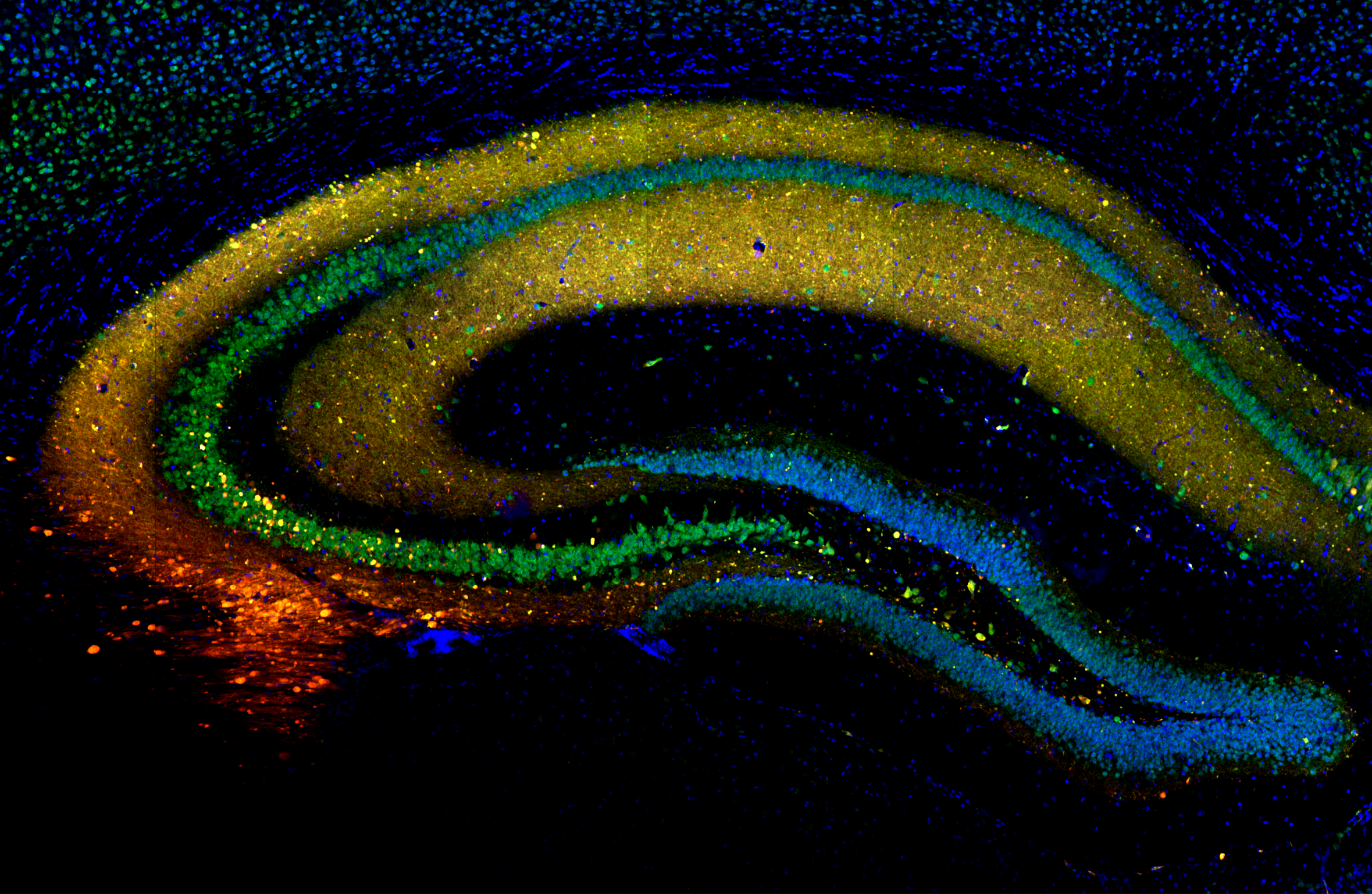 Image of mouse dosal hippocampus with a NeuN stain and mScarlet in many neurons