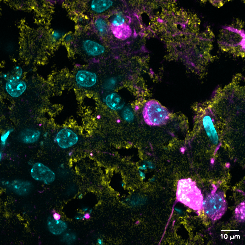 High magnification image of neurons expressing alpha synuclein